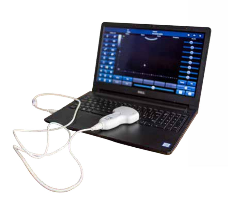 M-Scan Ultrasound Device